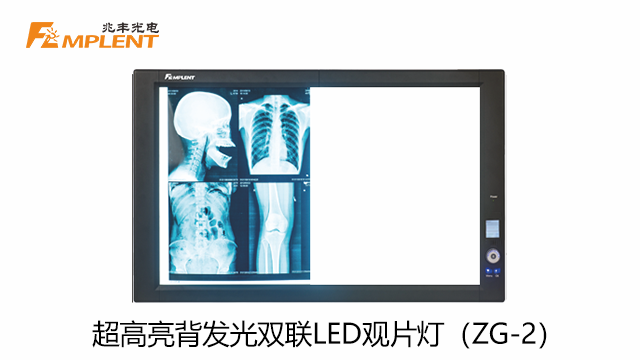 醫用觀片燈功率有多大？特性是什么？